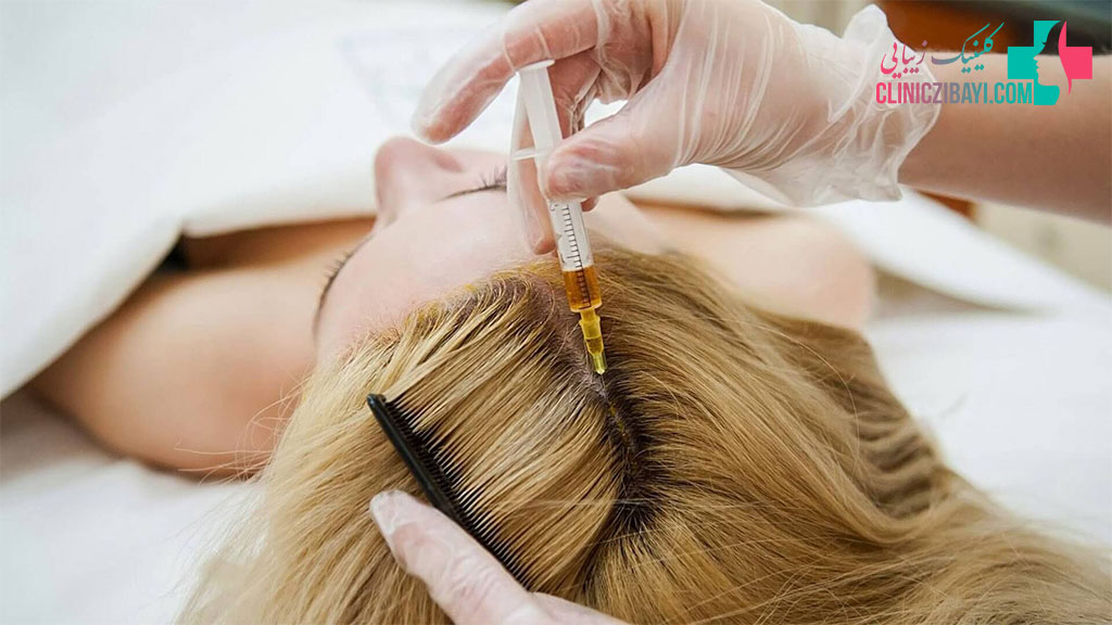 کاربردهای مزوتراپی مو چیست؟