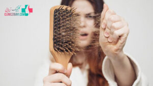 راه های موثر در درمان ریزش مو چیست؟