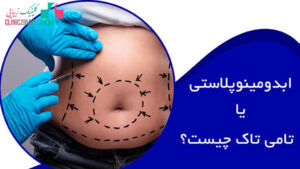 بهترین جراح ابدومینوپلاستی در تهران | ۱۰ بهترین جراح زیبایی شکم تهران