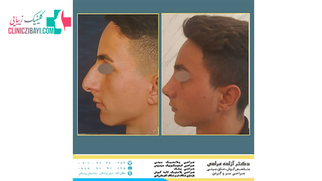 دکتر آزاده مرادی جراح زیبایی در شیراز