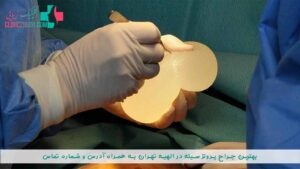 بهترین جراح پروتز سینه در الهیه تهران به همراه آدرس و شماره تماس