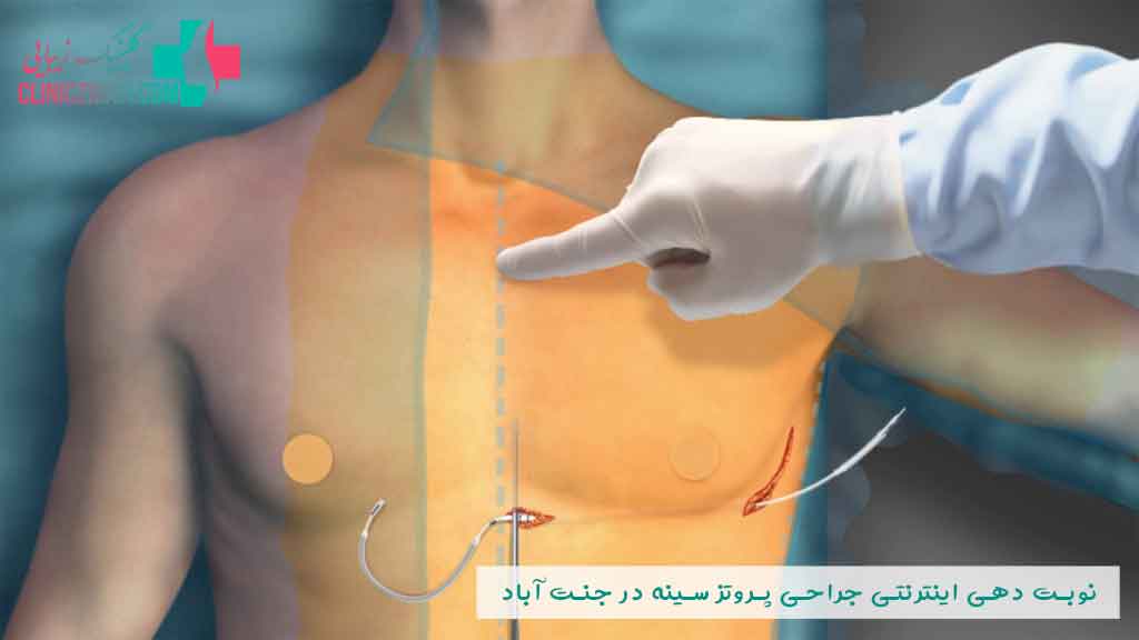 نوبت دهی اینترنتی جراح پروتز سینه در جنت آباد