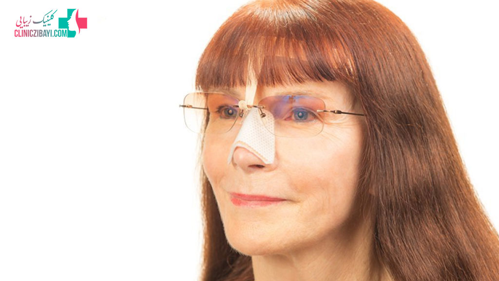استفاده از عینک بعد از جراحی بینی امکان پذیر است؟