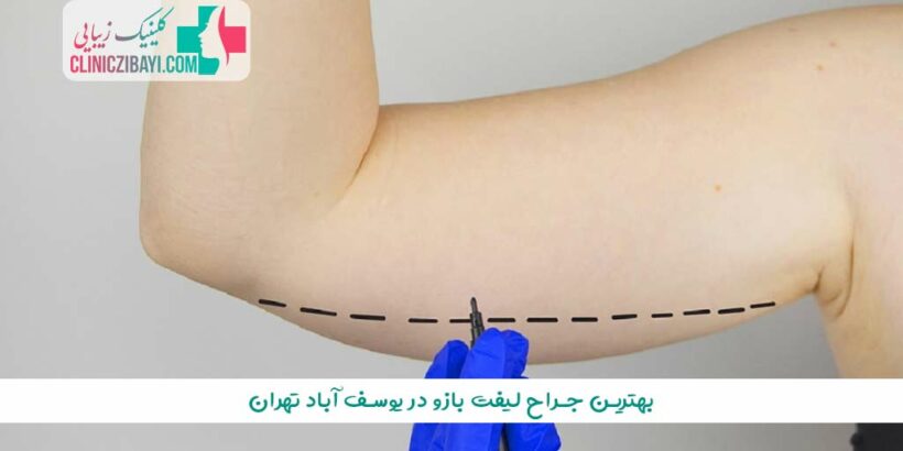 بهترین جراح لیفت بازو در یوسف آباد تهران