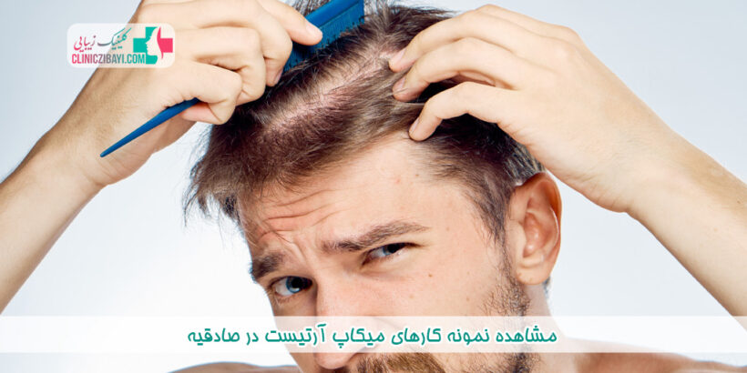 بهترین دکتر درمان ریزش مو در اسلامشهر
