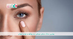 بهترین مرکز درمان سیاهی دور چشم در جردن تهران