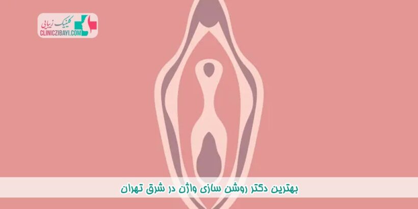 بهترین دکتر روشن سازی واژن در شرق تهران