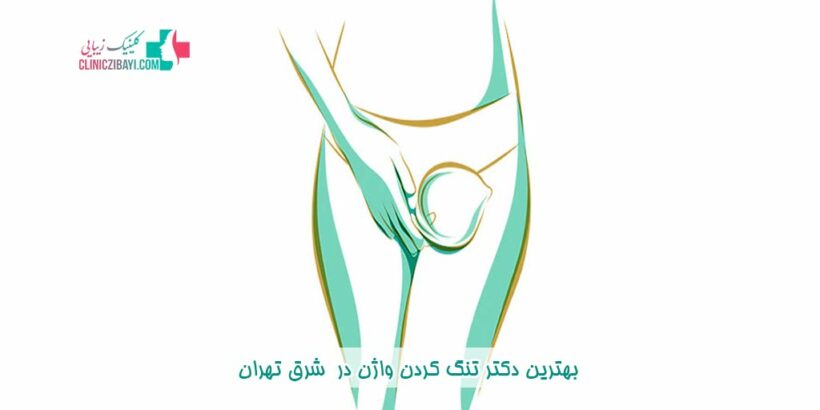 بهترین دکتر تنگ کردن واژن در شرق تهران