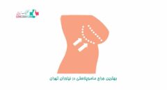 بهترین جراح ماموپلاستی در نیاوران تهران