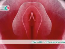 جراح زیبایی واژن در انقلاب تهران