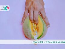 بهترین جراح زیبایی واژن در فرحزاد تهران