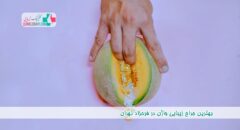 بهترین جراح زیبایی واژن در فرحزاد تهران