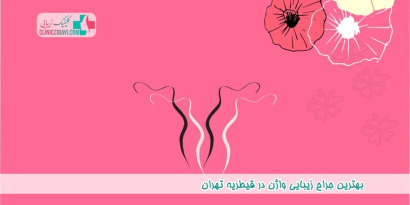 بهترین جراح زیبایی واژن در قیطریه تهران