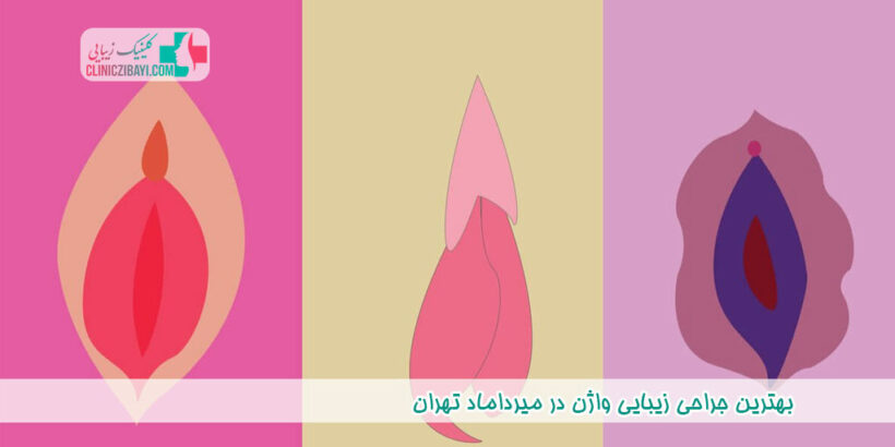 بهترین جراح زیبایی واژن در میرداماد تهران