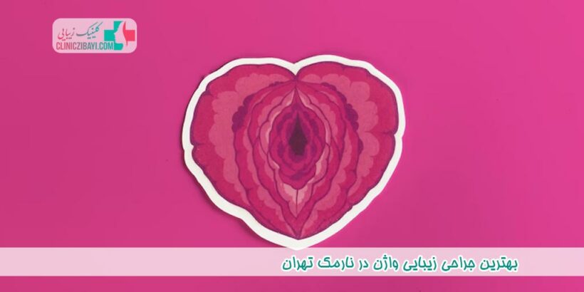بهترین جراحی زیبایی واژن در نارمک تهران