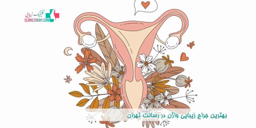 بهترین جراح زیبایی واژن در رسالت تهران