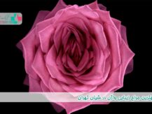 بهترین جراح زیبایی واژن در شیان تهران