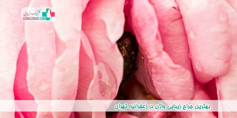 بهترین جراح زیبایی واژن در زعفرانیه تهران