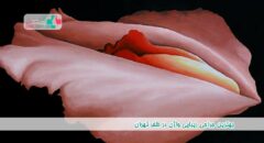 بهترین جراح زیبایی واژن در ظفر تهران