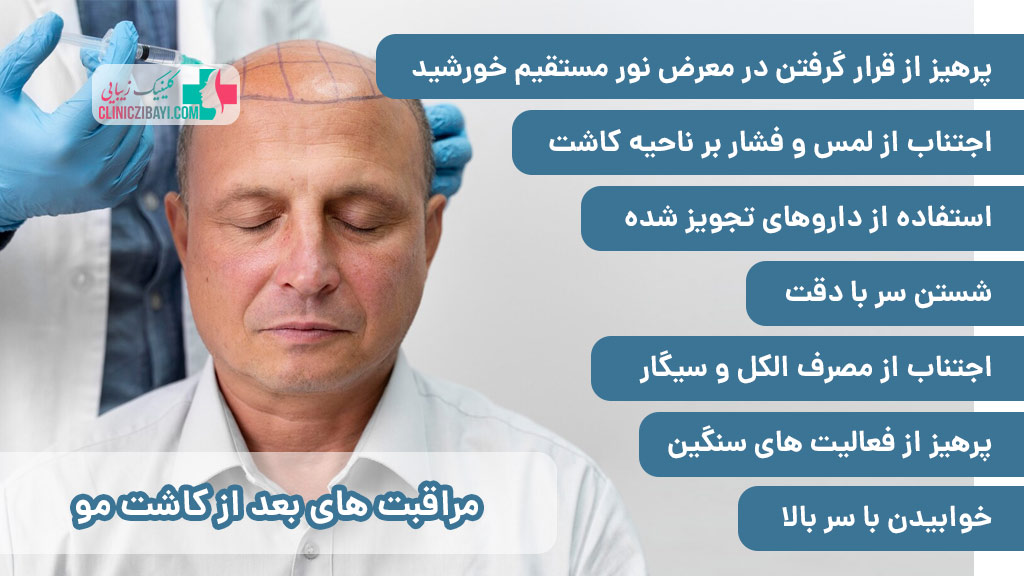 مراقبت های بعد از کاشت مو