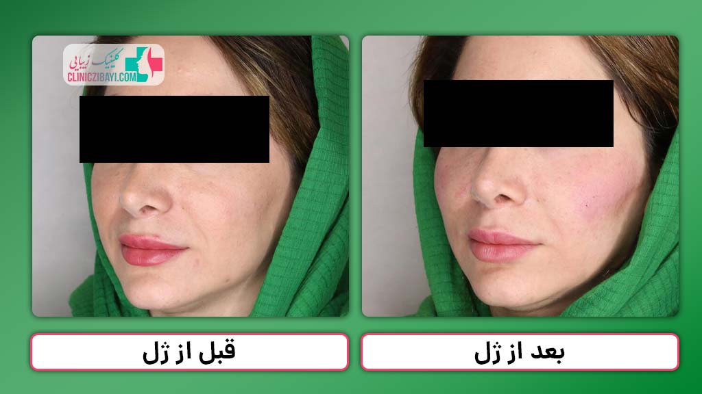 مشاهده نمونه کار کلینیک زیبایی در یاسوج