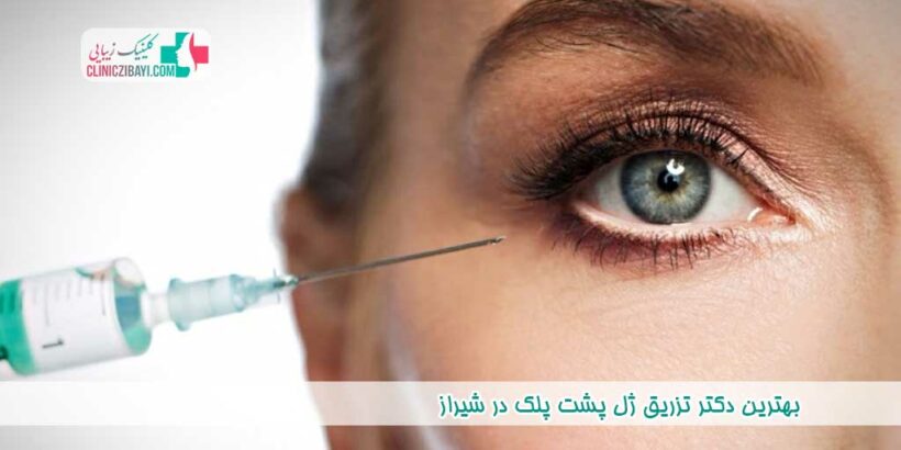 بهترین دکتر تزریق ژل پشت پلک در شیراز
