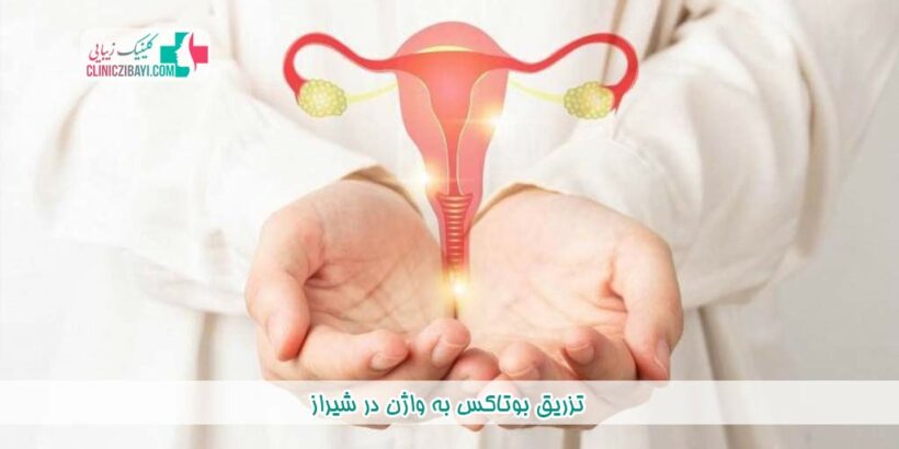 تزریق بوتاکس به واژن در شیراز