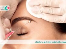 بهترین دکتر لیفت ابرو با نخ در ولنجک